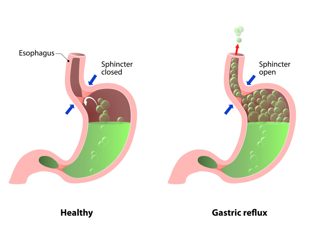 胃腸などの内臓に原因がある口臭は約20％程度に過ぎないという事