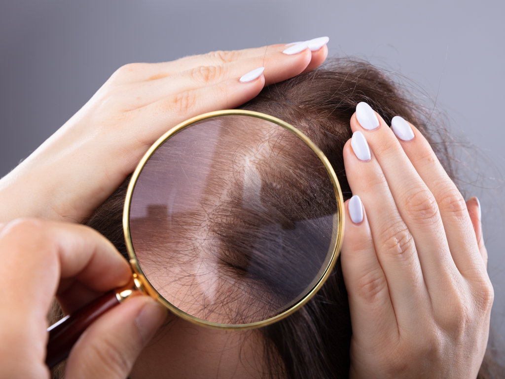 【髪の健康診断】毛髪・頭皮の健康状態をセルフチェックしてみよう！