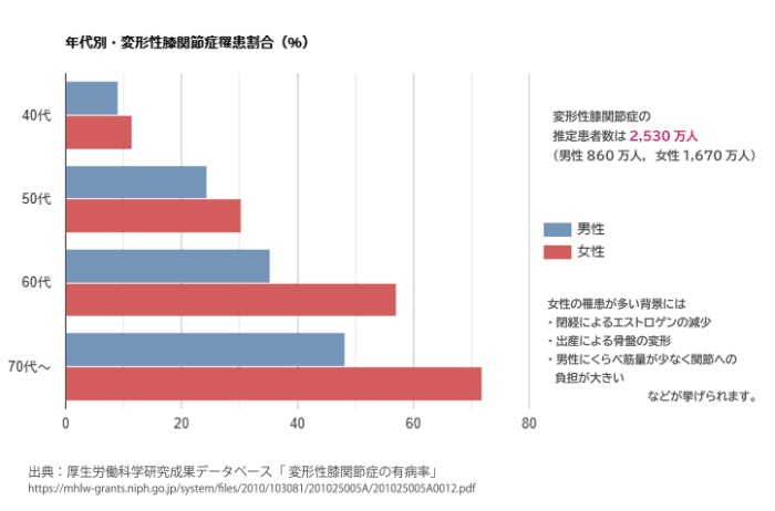膝痛の種類や場所によって異なるケア方法とおすすめケアグッズ