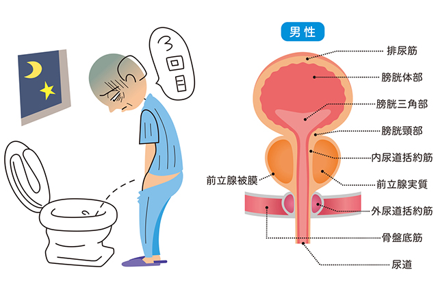 夜中の尿意はアルコールによる筋肉弛緩と脱水症状